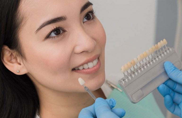 Esztétikai fogászat Oralcentrum Fogászat Érd